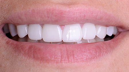 img-whitney-after.jpg