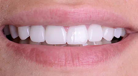 img-whitney-after.jpg